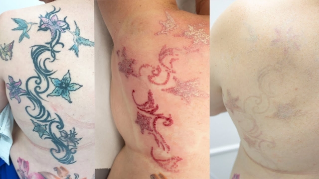 Celebrity Tattoo Regret – Megan Fox