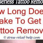 Dermatologists And Removal Of Tattoos