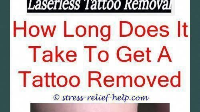 Dermatologists And Removal Of Tattoos