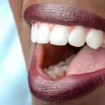 10 Effective Teeth Whitening Products for a Brilliant Smile!
