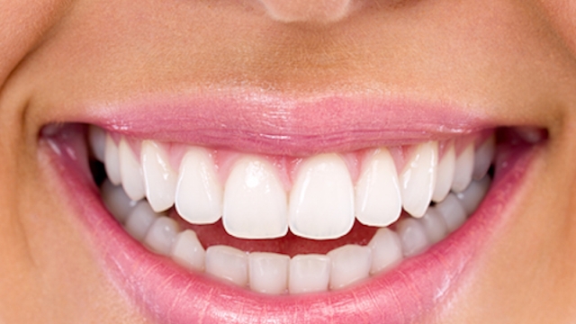 Shining Smiles: Unveiling the Secrets of Teeth Whitening Products