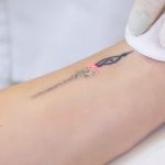 Tattoo Laser Removal – 7 Facts You Must Know About Removing Tattoos By Laser